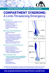 Syndromes / Compartment syndrome / Common fibular nerve / Ulnar nerve / Sural nerve / Radial nerve / Median nerve / Bone fractures / Musculoskeletal disorders / Anatomy / Health / Medicine