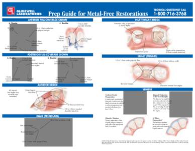 GLIDEWELL LABORATORIES Prep Guide for Metal-Free Restorations  ANTERIOR FULL-COVERAGE CROWN