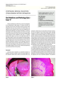 Oral pathology / Lichenoid eruptions / Dental materials / Restorative dentistry / Lichen planus / Mercury / Mucosal lichen planus / Amalgam / Dental restorative materials / Dentistry / Medicine / Health