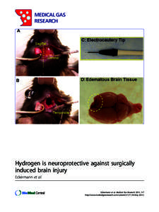 MEDICAL GAS RESEARCH Hydrogen is neuroprotective against surgically induced brain injury Eckermann et al.